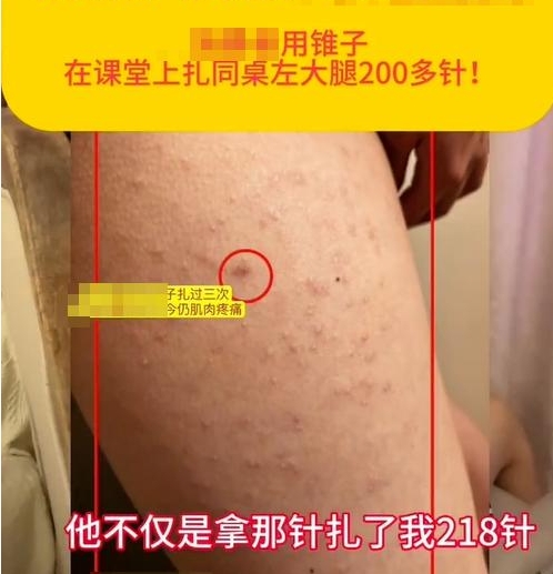 校園防欺凌報警器：“女生被同桌扎218針”，未達到校園霸凌標準？多方回應